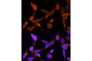 Immunofluorescence analysis of NIH-3T3 cells using VMP1 Polyclonal Antibody (ABIN7271283) at dilution of 1:100 (40x lens). (VMP1 抗体  (C-Term))