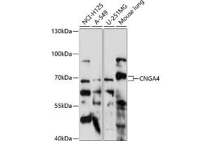 Western blot analysis of extracts of various cell lines, using CNG antibody (ABIN7266548) at 1:1000 dilution. (CNGA4 抗体  (AA 416-575))