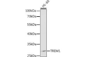 Western blot analysis of extracts of HL-60 cells, using TREM1 antibody (ABIN3020894, ABIN3020895, ABIN3020896 and ABIN6213780) at 1:1000 dilution.