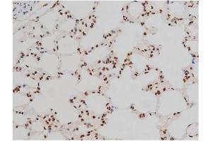 Immunohistochemistry (IHC) image for anti-Activating Transcription Factor 2 (ATF2) (pThr51), (pThr69) antibody (ABIN6256594)
