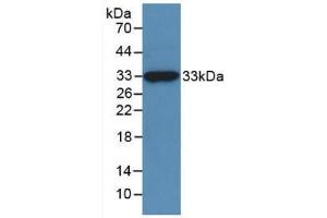 Western blot analysis of recombinant Human NAGase. (MGEA5 抗体  (AA 6-240))