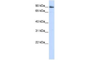 Western Blotting (WB) image for anti-Proprotein Convertase Subtilisin/kexin Type 5 (PCSK5) (Middle Region) antibody (ABIN2781306)
