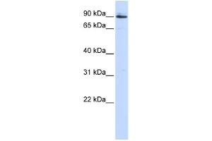 WB Suggested Anti-PCSK5 Antibody Titration:  0. (PCSK5 抗体  (Middle Region))