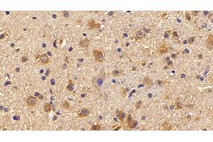 Detection of PNMA2 in Rat Cerebrum Tissue using Polyclonal Antibody to Paraneoplastic Antigen MA2 (PNMA2) (PNMA2 抗体  (AA 74-333))