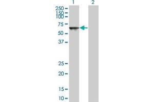Western Blot analysis of TOE1 expression in transfected 293T cell line by TOE1 monoclonal antibody (M03A), clone 1D4. (TOE1 抗体  (AA 1-510))