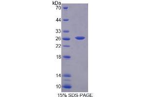 SDS-PAGE analysis of Mouse BCAT1 Protein. (BCAT1 蛋白)