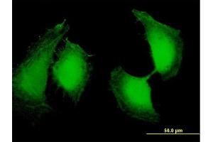 Immunofluorescence of purified MaxPab antibody to OSTF1 on HeLa cell. (OSTF1 抗体  (AA 1-217))
