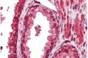 Human Prostate (formalin-fixed, paraffin-embedded) stained with ATF4 antibody ABIN462203 followed by biotinylated goat anti-rabbit IgG secondary antibody ABIN481713, alkaline phosphatase-streptavidin and chromogen. (ATF4 抗体  (N-Term))