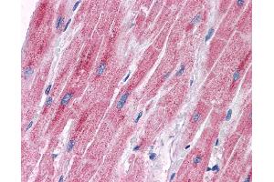 Immunohistochemistry (IHC) image for anti-Pyruvate Dehydrogenase Kinase, Isozyme 2 (PDK2) (Middle Region) antibody (ABIN2777433) (PDK2 抗体  (Middle Region))
