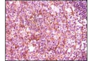 Immunohistochemistry (IHC) image for anti-Dynamin 1 (DNM1) (truncated) antibody (ABIN2464046) (Dynamin 1 抗体  (truncated))