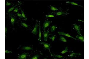Immunofluorescence (IF) image for anti-Ring Finger Protein 40, E3 Ubiquitin Protein Ligase (RNF40) (AA 102-200) antibody (ABIN523241)
