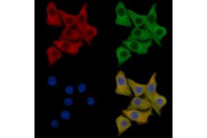 PDGF Receptor alpha Mouse Monoclonal Antibody staining HepG2 cells by IF/ICC. (PDGFRA 抗体  (Internal Region))