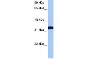 WB Suggested Anti-LDHC Antibody Titration: 0.