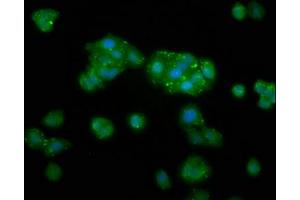 Immunofluorescence staining of HepG2 cells with ABIN7173411 at 1:133, counter-stained with DAPI. (DAK 抗体  (AA 396-561))