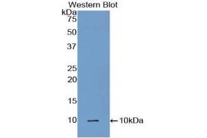 Western blot analysis of the recombinant protein. (C5A 抗体  (AA 679-755))