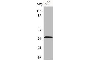 Western Blot analysis of HeLa cells using ELOVL4 Polyclonal Antibody (ELOVL4 抗体  (Internal Region))