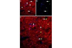 Expression of neuropeptide Y5 receptor in rat striatum - Immunohistochemical staining of rat striatum using Anti-NPY5R Antibody (ABIN7043375 and ABIN7044673). (NPY5R 抗体  (AA 291-306))