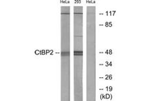 Western blot analysis of extracts from HeLa/293 cells, using CtBP2 Antibody. (CTBP2 抗体  (AA 396-445))