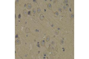 Immunohistochemistry of paraffin-embedded rat brain using PIK3R1 antibody. (PIK3R1 抗体)