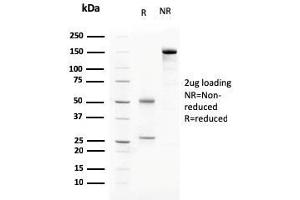 SDS-PAGE Analysis Purified C1QA Mouse Monoclonal Antibody (C1QA/2783). (C1QA 抗体  (AA 104-237))