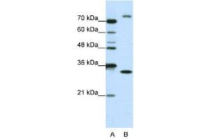 WB Suggested Anti-EXOSC2  Antibody Titration: 1. (EXOSC2 抗体  (N-Term))