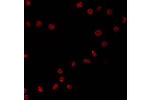 ABIN6266531 staining COS7 by IF/ICC. (E2F4 抗体)
