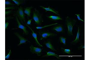 Immunofluorescence of purified MaxPab antibody to NQO2 on HeLa cell. (NQO2 抗体  (AA 1-231))