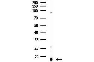 Western blot analysis of lysates from PC12 cells(LPS 4h treatment), using CDK / DOC1 Antibody at 1/1000 dilution.