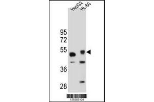 Western blot analysis in HepG2 and HL-60 cell line lysates (35ug/lane). (TIGD3 抗体  (C-Term))