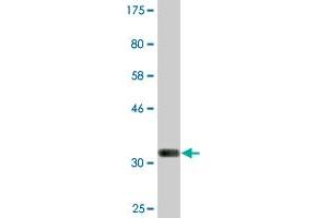 Western Blot detection against Immunogen (36. (GOLM1 抗体  (AA 302-401))