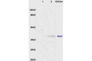 Lane 1: mouse lung lysates Lane 2: mouse brain lysates probed with Anti CNR2/CB2 Polyclonal Antibody, Unconjugated (ABIN680168) at 1:200 in 4 °C. (CNR2 抗体  (AA 251-350))