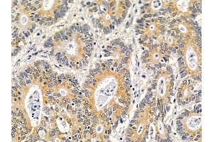 anti-Interleukin 20 Receptor alpha (IL20RA) (C-Term) antibody