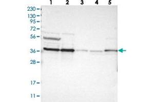 Western blot analysis of Lane 1: RT-4, Lane 2: U-251 MG, Lane 3: Human Plasma, Lane 4: Liver, Lane 5: Tonsil with CALHM2 polyclonal antibody . (CALHM2 抗体)