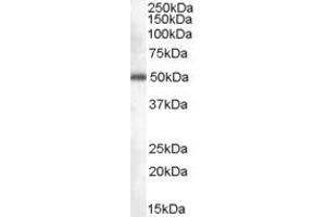 Western Blotting (WB) image for anti-CDK5 Regulatory Subunit Associated Protein 3 (CDK5RAP3) (C-Term) antibody (ABIN2774329)