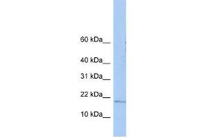 ZNHIT3 antibody used at 0. (ZNHIT3 抗体  (N-Term))