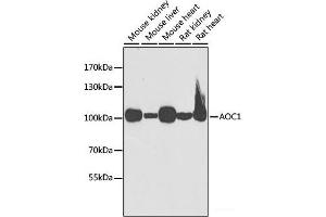 Western blot analysis of extracts of various cell lines using AOC1 Polyclonal Antibody at dilution of 1:1000. (DAO 抗体)