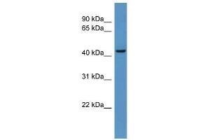 B4galt6 antibody used at 0. (B4GALT6 抗体  (C-Term))