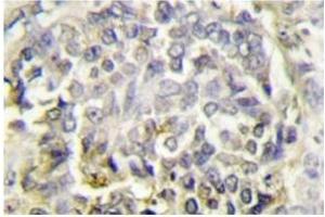 Image no. 1 for anti-PYD and CARD Domain Containing (PYCARD) antibody (ABIN272291) (PYCARD 抗体)