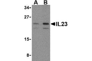 Western blot analysis of IL-23 in mouse pancreas tissue lysate with AP30419PU-N IL-23 antibody at (A) 1 and (B) 2 μg/ml. (IL23A 抗体  (N-Term))