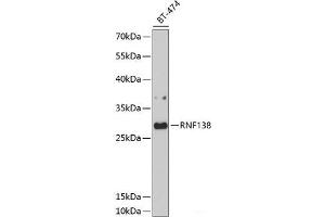Western blot analysis of extracts of BT-474 cells using RNF138 Polyclonal Antibody at dilution of 1:1000. (RNF138 抗体)