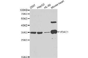 Western blot analysis of extracts of various cell lines, using VDAC1 antibody. (VDAC1 抗体  (AA 1-283))
