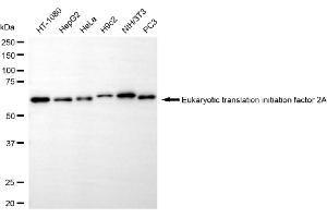 Western blotting analysis using eukaryotic translation initiation factor 2A antibody (ABIN7798513). (Recombinant EIF2A 抗体)