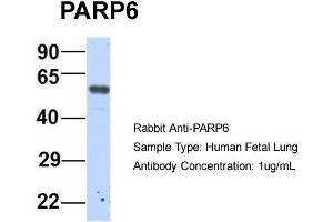 Host:  Rabbit  Target Name:  P Sample Type:  Human Fetal Lung  Antibody Dilution:  1. (PARP6 抗体  (N-Term))