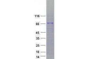 Western Blotting (WB) image for Zinc Finger Protein 205 (ZNF205) (Transcript Variant 1) protein (Myc-DYKDDDDK Tag) (ABIN2735956)