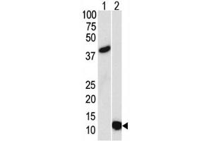 Western blot analysis of SUMO3 antibody and (1) GST-SUMO3 recombinant protein and (2) HL-60 lysate. (SUMO3 抗体)