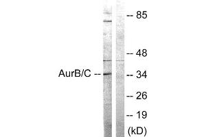 Western Blotting (WB) image for anti-Aurora Kinase B/C (AURKB/C) (Thr175), (Thr202) antibody (ABIN1848068) (AurB/C 抗体  (Thr175, Thr202))