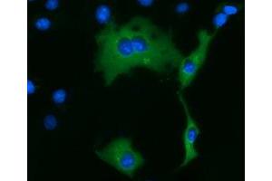 Anti-KLHL2 mouse monoclonal antibody (ABIN2453208) immunofluorescent staining of COS7 cells transiently transfected by pCMV6-ENTRY KLHL2 (RC205347). (KLHL2 抗体  (AA 1-100, AA 494-593))