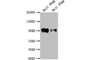 Western Blot Positive WB detected in: Raji whole cell lysate All lanes: CD19 antibody at 1:2000 Secondary Goat polyclonal to Mouse IgG at 1/10000 dilution Predicted band size: 61 kDa Observed band size: 95 kDa (CD19 抗体  (AA 20-291))