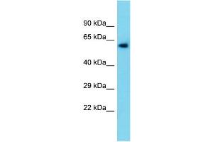 Host:  Rabbit  Target Name:  Tymp  Sample Type:  Rat Liver lysates  Antibody Dilution:  1. (Thymidine Phosphorylase 抗体  (N-Term))