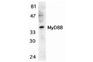 Western Blotting (WB) image for anti-Myeloid Differentiation Primary Response Gene (88) (MYD88) (C-Term) antibody (ABIN1030526) (MYD88 抗体  (C-Term))